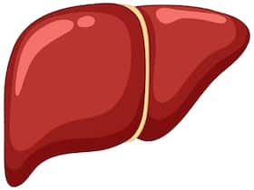 Polycystic Liver Disease (PLD): Causes, Symptoms, Treatment