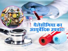 थैलेसीमिया का इन आयुर्वेदिक तरीकों से करें इलाज, जानिए एक्सपर्ट ने क्या बताए इनके लाभ