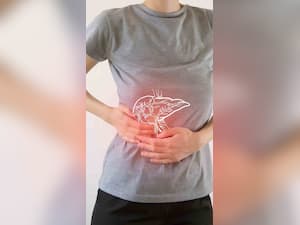 Top 10 Foods To Avoid With Fatty Liver Disease