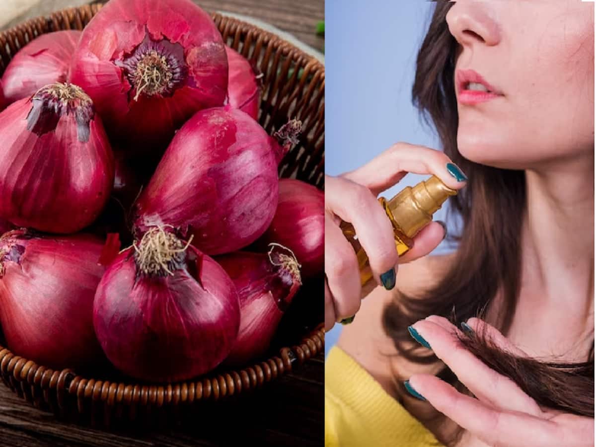 Onion Oil For Hair: Benefits, Side Effects And How To Use It