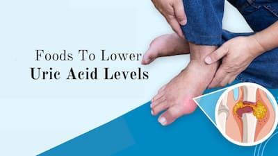 High Uric Acid: 5 Foods To Add In Your Diet To Lower Uric Acid Levels Naturally