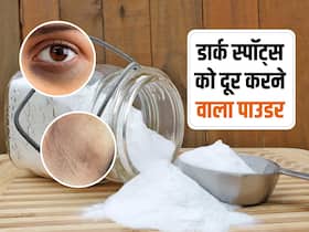 किचन में रखें इस सफेद पाउडर की एक चुटकी से साफ हो जाएंगे स्किन के डार्क स्पॉट, ऐसे दूर करें जिद्दी निशान