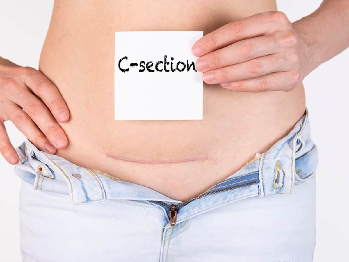 diet-for-c-section-delivery