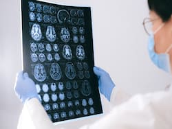 Concussions: Why You Need To Take Them Seriously?