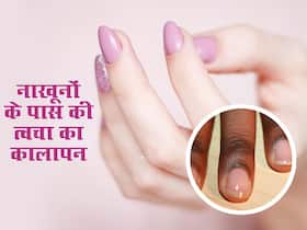 नाखूनों के आसपास की त्वचा पड़ने लगी है काली? इस खास घरेलू नुस्खे से करें जिद्दी कालेपन को दूर