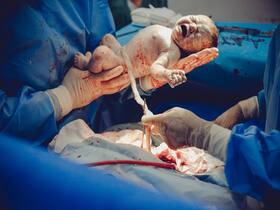 Preterm Birth Complications: Jaundice, Breathing Problems Among Others