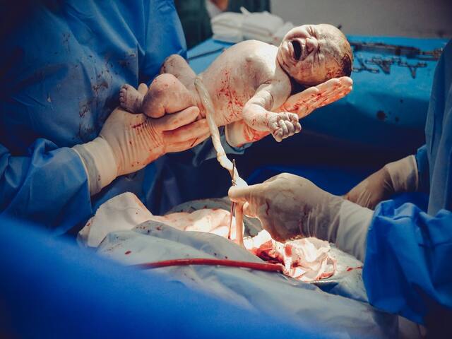 Preterm Birth Complications: Jaundice, Distressed Breathing Among Others