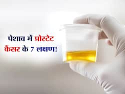 40 के बाद पेशाब में दिखे ये 7 लक्षण तो तुरंत कराएं प्रोस्टेट टेस्ट! जानें क्यों 40 के बाद प्रोस्टेट जांच होती है जरूरी