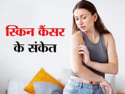 त्वचा के कैंसर का संकेत हैं शरीर पर दिखने वाले ये 6 लक्षण, जानिए कैसे करें इसकी पहचान