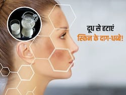 चेहरे पर जिद्दी दाग हटाने के लिए दूध में मिलाकर लगाएं ये चीजें, सप्ताहभर में स्किन की सारी समस्याओं में मिलेगा छुटकारा