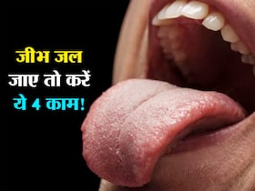 चाय, कॉफी, गर्म समोसे से जली जीभ? 4 नुस्खे आजमाएं मिलेगी तुरंत राहत और छाले का खतरा होगा कम