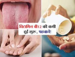 शरीर में ये 8 बदलाव बताते हैं Vitamin B12 की कमी हो गई है शुरू! जानें कमी को दूर करने वाले हेल्दी फूड्स