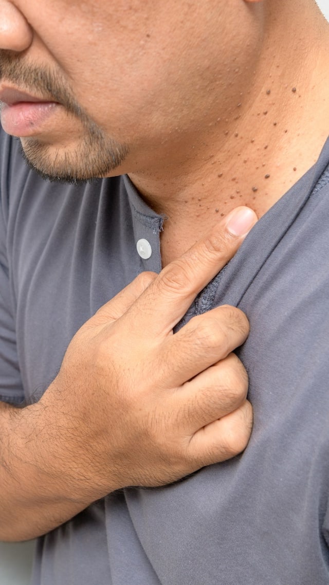 Diabetes: 10 warning signs that can appear on your skin