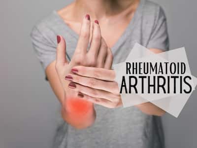 10 Unusual Symptoms of Rheumatoid Arthritis That Shouldn't Be Ignored