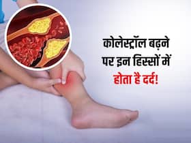 शरीर के इन 3 हिस्सों में हो रहा है असहनीय दर्द? समझ जाएं ब्लड में बढ़ गया है बैड कोलेस्ट्रॉल