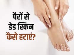 पैरों और एड़ियों में डेड स्किन निकालना है आसान, बस ट्राई करें ये घरेलू नुस्खे