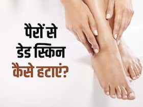 पैरों और एड़ियों में डेड स्किन निकालना है आसान, बस ट्राई करें ये घरेलू नुस्खे