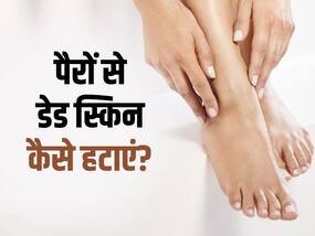 पैरों और एड़ियों में डेड स्किन निकालना है आसान, बस ट्राई करें ये घरेलू नुस्खे पैरों और एड़ियों में डेड स्किन निकालना है आसान, बस ट्राई करें ये घरेलू नुस्खे