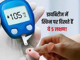 डायबिटीज में स्किन पर दिखते हैं ये 5 तरह के बदलाव, समय पर इलाज न कराने पर गंभीर हो सकती है स्थिति