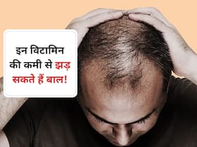 शरीर में इन विटामिन्स की कमी से गंजे हो सकते हैं आप, इन चीजों से करें इसकी पूर्ति