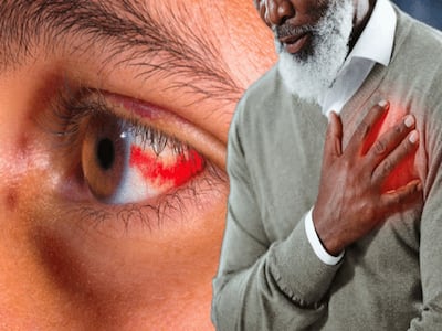 10 Warning Symptoms of Heart Attack That Can Appear In Your Eyes