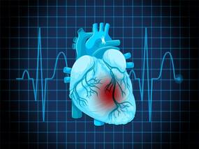 Heart Failure: Cardiac Amyloidosis May Be Reversed Using Antibodies From Survivors, Says Study