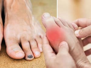 From no hair to always being cold - what your toes can reveal