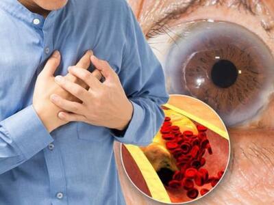 High Cholesterol Can Be Devastating For Your Heart: Here's What May Happen