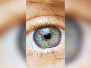 Dry Eyes Vs Healthy Eyes: Who Is More Likely To Suffer From Cornea Injuries?