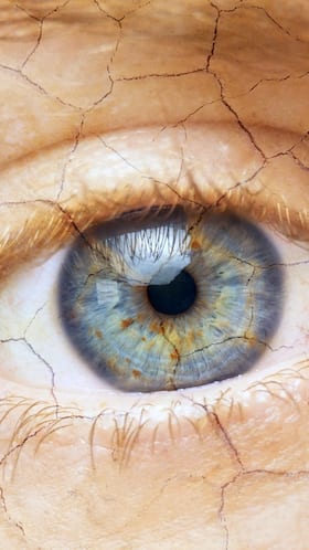 Dry Eyes Vs Healthy Eyes: Who Is More Likely To Suffer From Cornea Injuries? Dry Eyes Vs Healthy Eyes: Who Is More Likely To Suffer From Cornea Injuries?