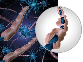 Multiple Sclerosis Home Remedies: 7 Daily Tips for Managing The Symptoms Multiple Sclerosis Home Remedies: 7 Daily Tips for Managing The Symptoms
