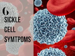 Sickle Cell Symptoms: Unusual Swelling In The Feet And 5 Other Warning Signs You Should Not Ignore