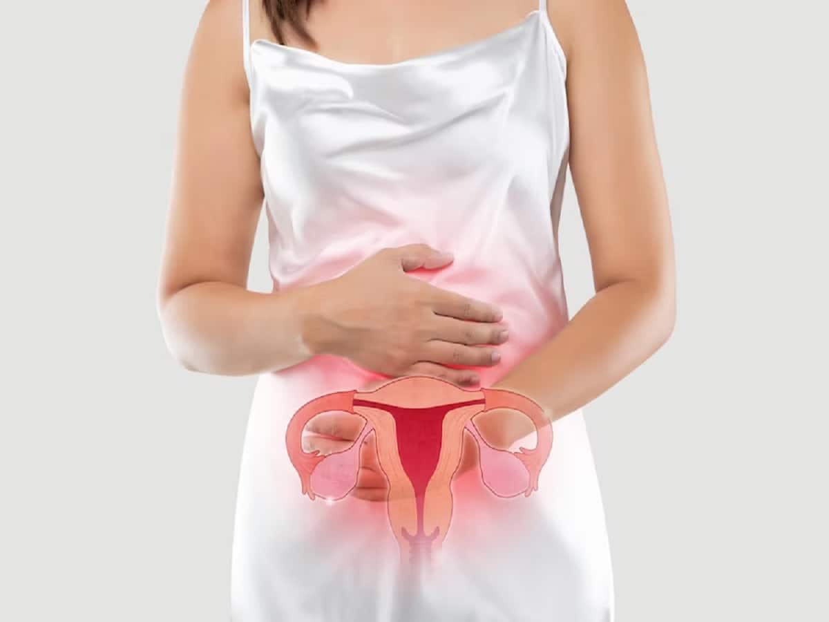 Para-Ovarian Cysts In Teenage girls Often Grow Large: Symptoms To Watch Out For