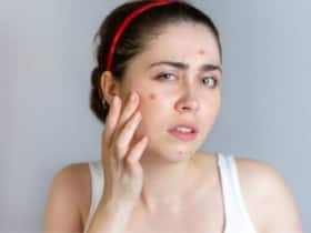 Suffering From Breakouts? Expert Issues Warning On Acne-Inducing Supplements