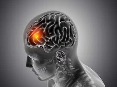 World Brain Tumor Day 2023: Things About Brain Tumor That Most People Don’t Know