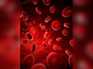 6 Types of Anemia In A Child And Their Symptoms