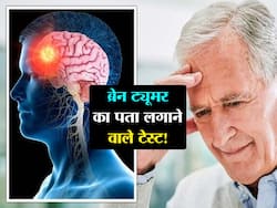 इन 6 टेस्ट की मदद से चल सकता है ब्रेन ट्यूमर का पता! एक्सपर्ट से जानें ब्रेन ट्यूमर से पहले दिखने वाले लक्षण