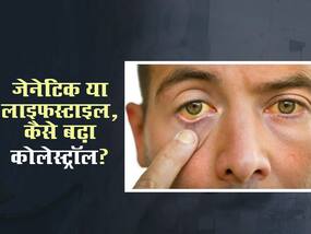 जेनेटिक या लाइफस्टाइल? किस गलती से बढ़ा आपका कोलेस्ट्रॉल, इन 2 तरीकों से पहचानें अंतर
