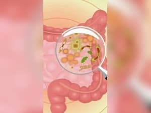 Poor Gut Health Can Cause Diseases: What Is The Link Between Them?