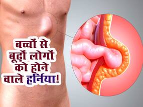 हर्निया के 5 प्रकार, जो कर देंगे आपको परेशान! 6 महीने के बच्चे से लेकर बूढ़े लोगों को इस तरह का होता है हर्निया