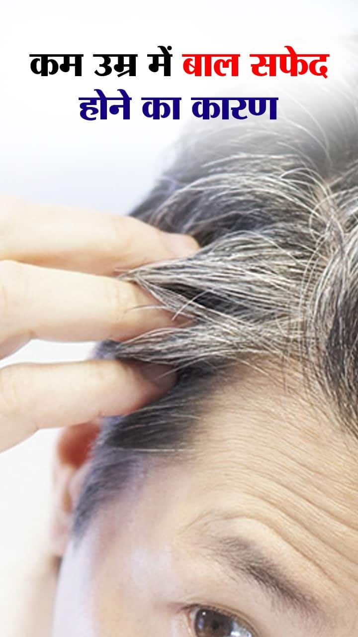 Grey Hair Treatment,White Hair Problem: क्या यंग ऐज में दिखने लगे हैं सफेद  बाल? जानें इन्हें काला रखने का तरीका - premature grey hair remedies by  expert - Navbharat Times