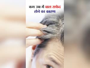 कम उम्र में बाल सफेद क्यों होते हैं?