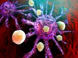 Japanese Develop New Therapy For Multiple Types Of Cancer