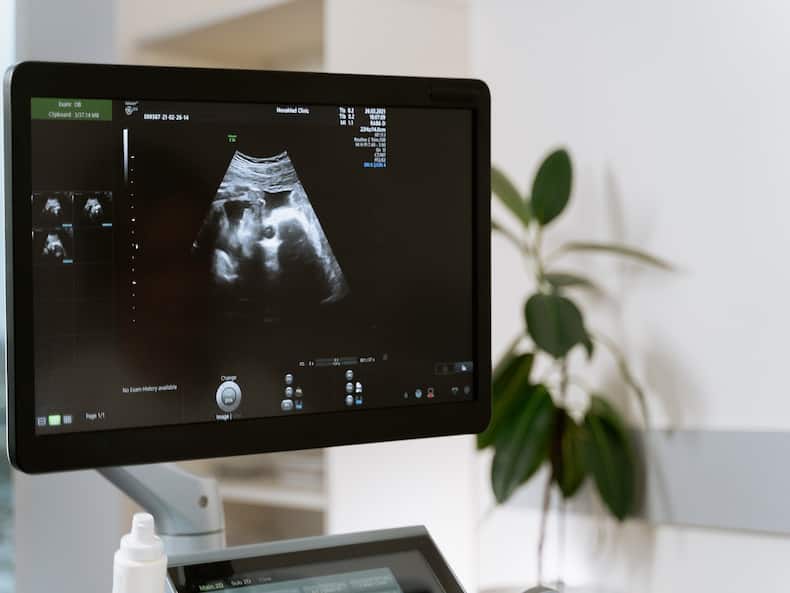 Pregnancy Tests: 5 Routine Screenings You Must Never Forget To Get