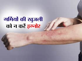 गर्मियों में बार-बार होने वाली खुजली को न करें इग्नोर, हो सकती हैं स्किन से जुड़ी ये 4 बीमारियां
