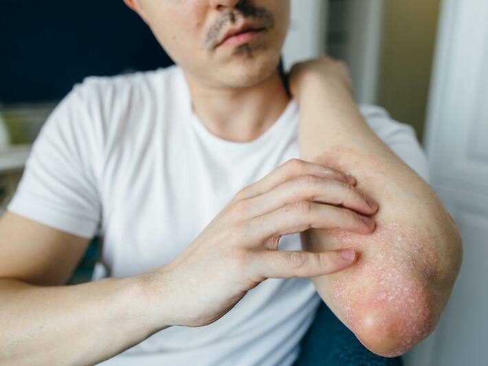 गर्मियों से परेशान होकर बारबार नहाने वाले सावधान! इससे सेहत को हो सकती