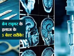 ब्रेन ट्यूमर के उपचार में काम आएंगी ये 5 टेक्निक! एक्सपर्ट से जानें ट्यूमर के उपचार का कारगर तरीका