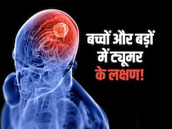 रोज सिरदर्द के लिए खा रहे गोलियां? बार-बार सिरदर्द ब्रेन ट्यूमर का लक्षण, जानें बच्चों से लेकर बड़ों में दिखने वाले लक्षण