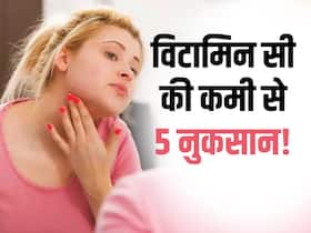 शरीर में विटामिन सी की कमी पर हो सकती है ये 5 गंभीर बीमारियां, जानें कौन सा अंग सबसे पहला होता है कमजोर शरीर में विटामिन सी की कमी पर हो सकती है ये 5 गंभीर बीमारियां, जानें कौन सा अंग सबसे पहला होता है कमजोर