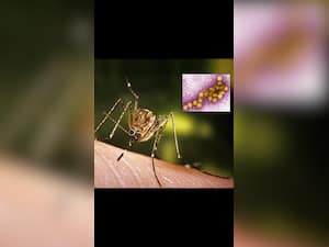 7 West Nile Virus Symptoms: Spot The Signs For Quick Medical Action